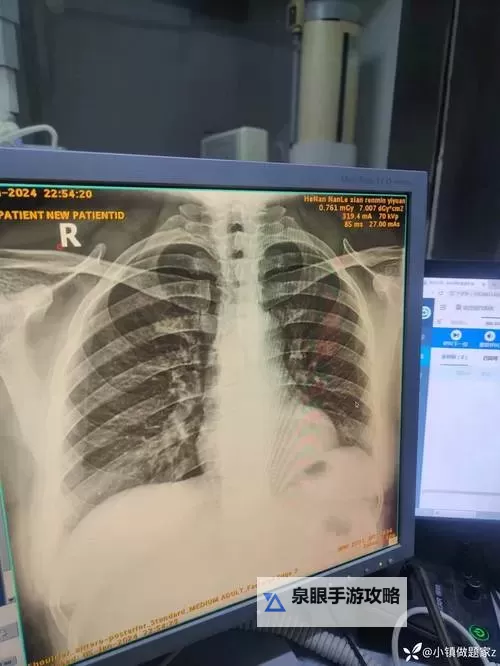 我想看胸片曝光2025最新动态已更新,今日更新全面解析图1