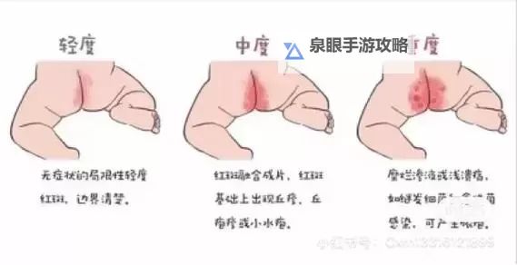 控人插棉签规则图片简单易懂：详解操作步骤与注意事项图1